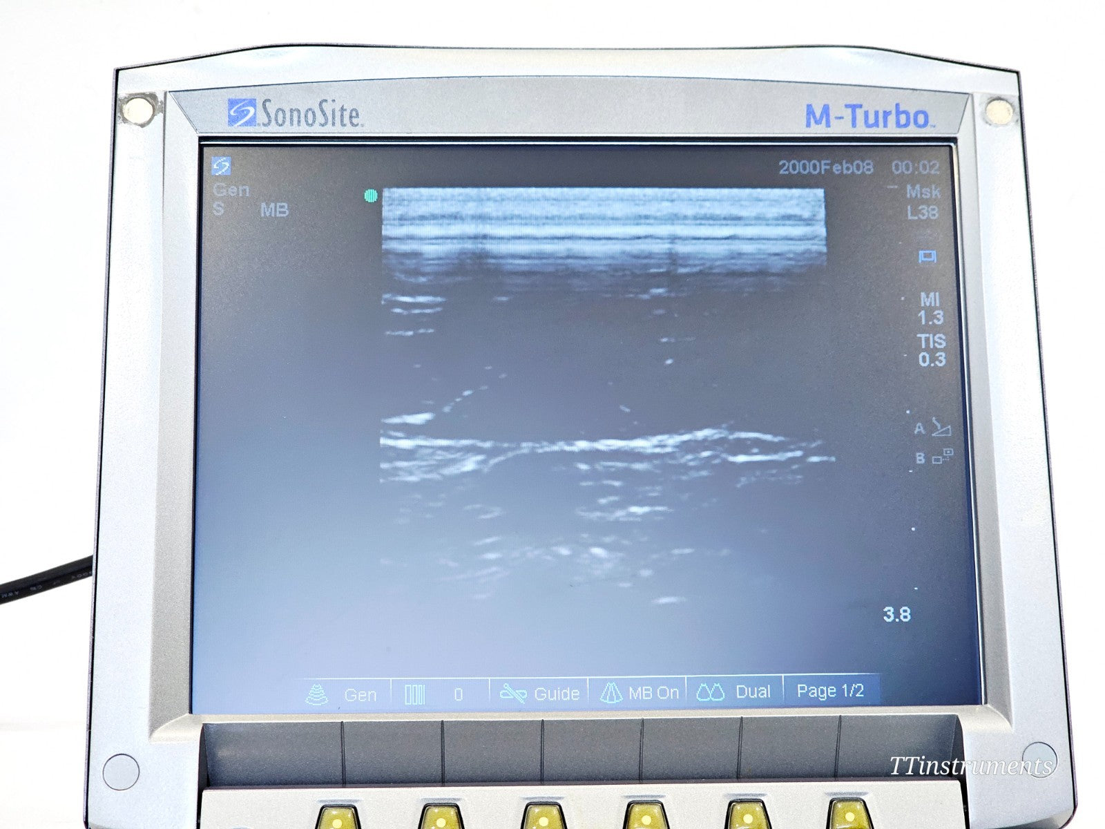 SonoSite P08189-77 M Turbo Ultrasound System w/ Transducer L38xi/10-5 MHz