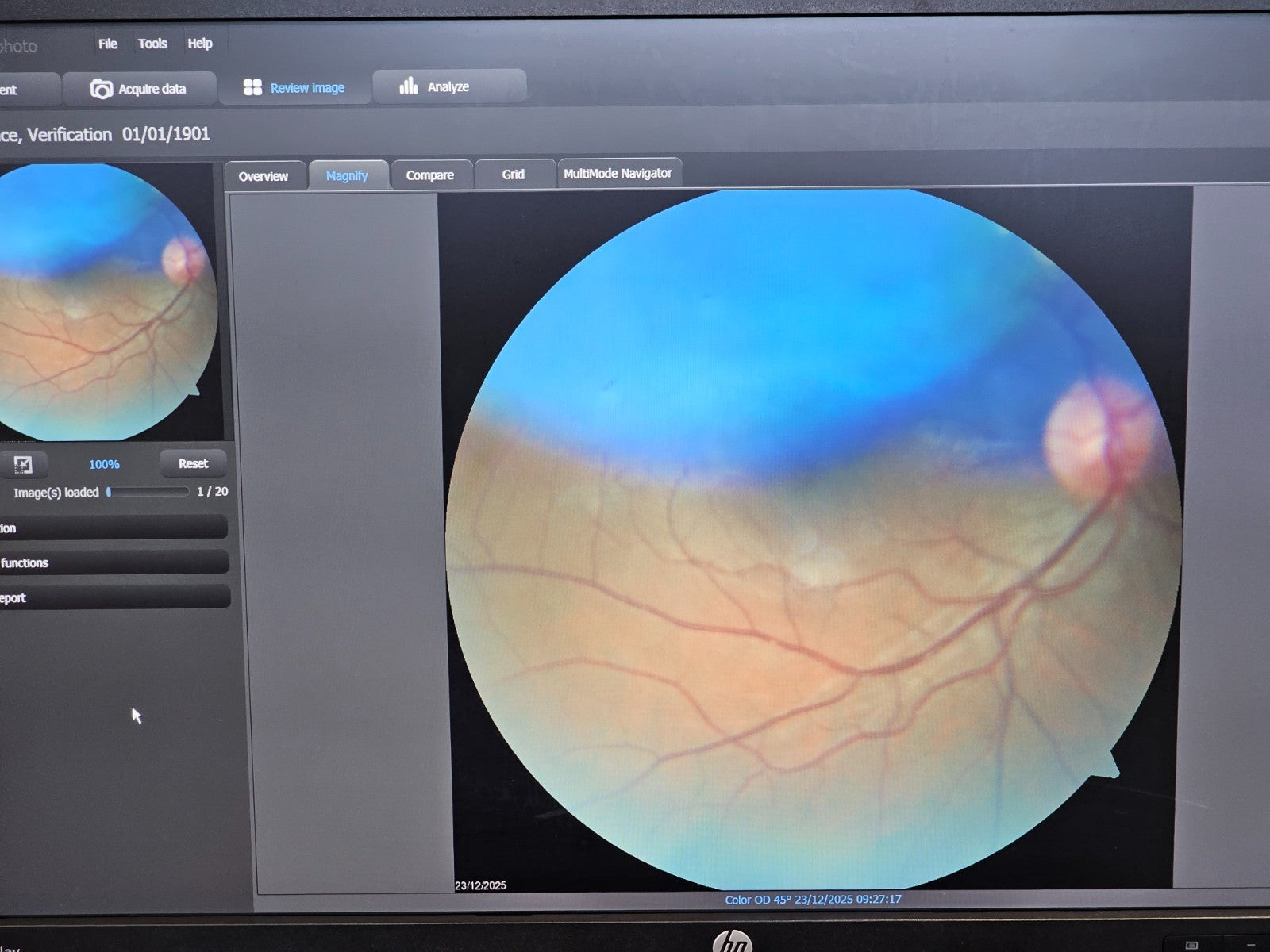 Zeiss Cirrus Photo 600 OCT Fundus Camera + OCT Engine + PC + Software