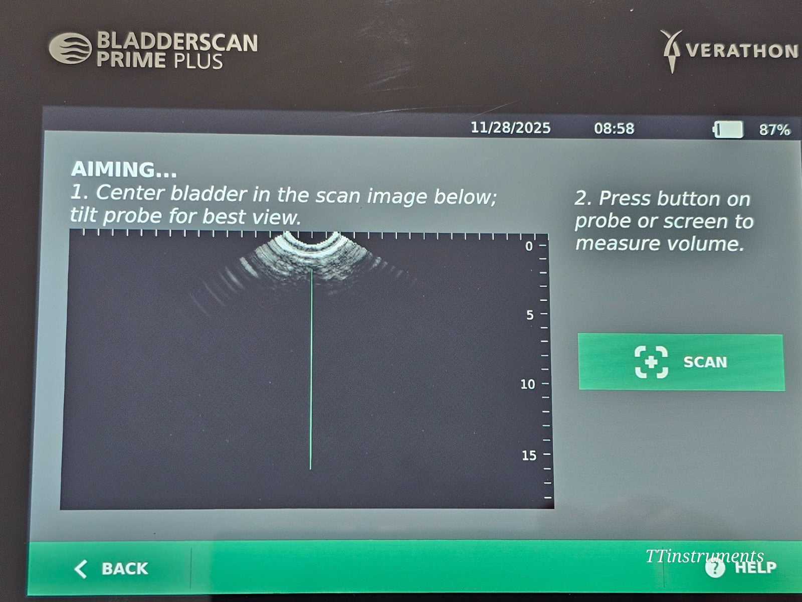 Verathon BladderScan Prime Plus console port and connector detail