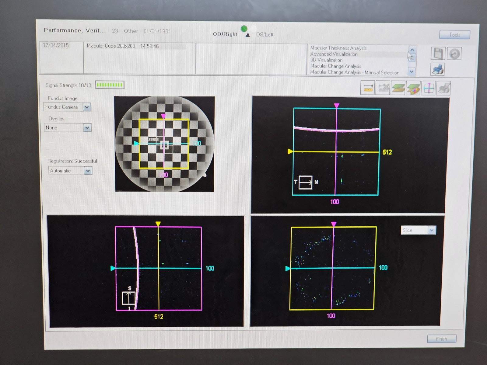 Zeiss Cirrus Photo 600 OCT Fundus Camera + OCT Engine + PC + Software
