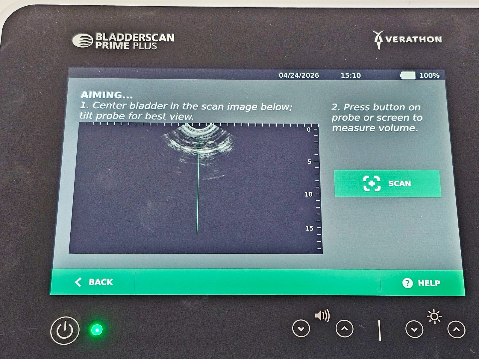 Verathon BladderScan complete unit with included components