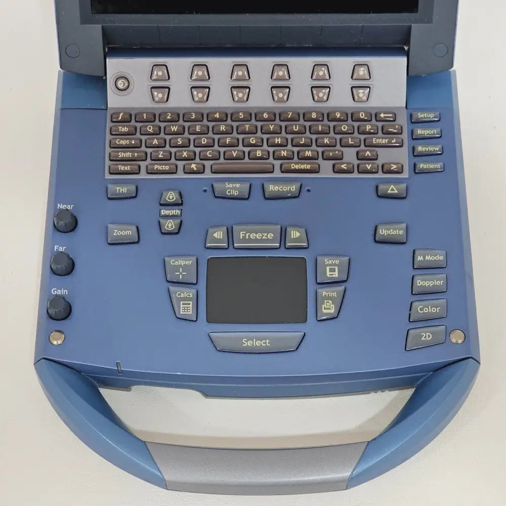 SonoSite MicroMaxx portable ultrasound system and docking station