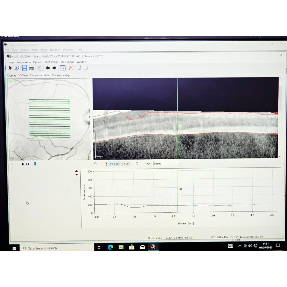 Heidelberg Engineering HRA + OCT Spectralis Imaging System MFD 2012