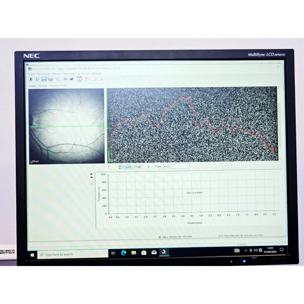 Heidelberg Engineering HRA + OCT Spectralis Imaging System MFD 2012
