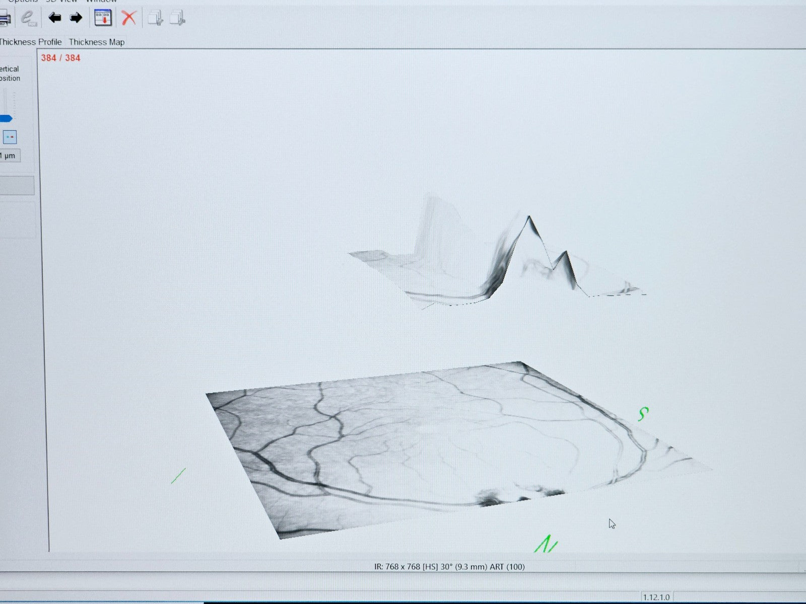 Heidelberg Engineering HRA + OCT Spectralis Optometry Imaging System w/ Software