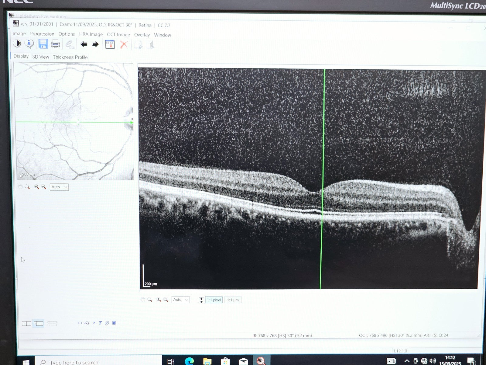 Heidelberg Engineering HRA + OCT Spectralis Optometry Imaging System w/ Software