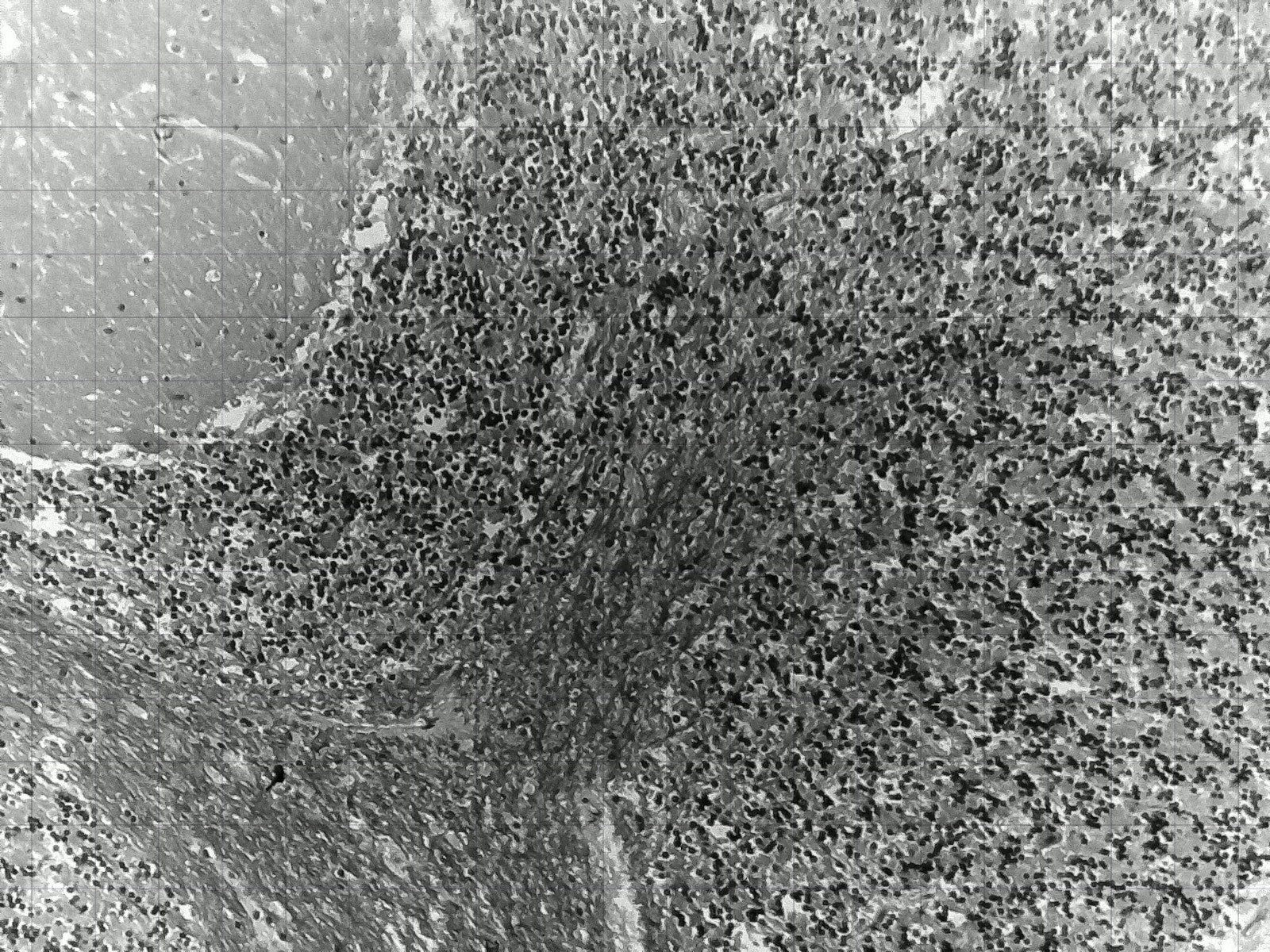 iolight Compact Cell Imager 1mm FoV Inverted Microscope 10x Objective