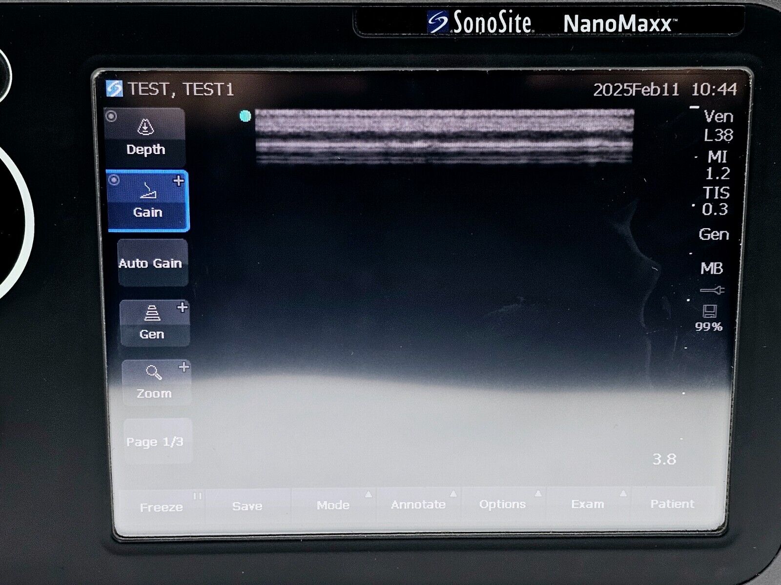 SonoSite NanoMaxx Ultrasound System P11111-37 w/ L38n-10-5 MHz Transducer