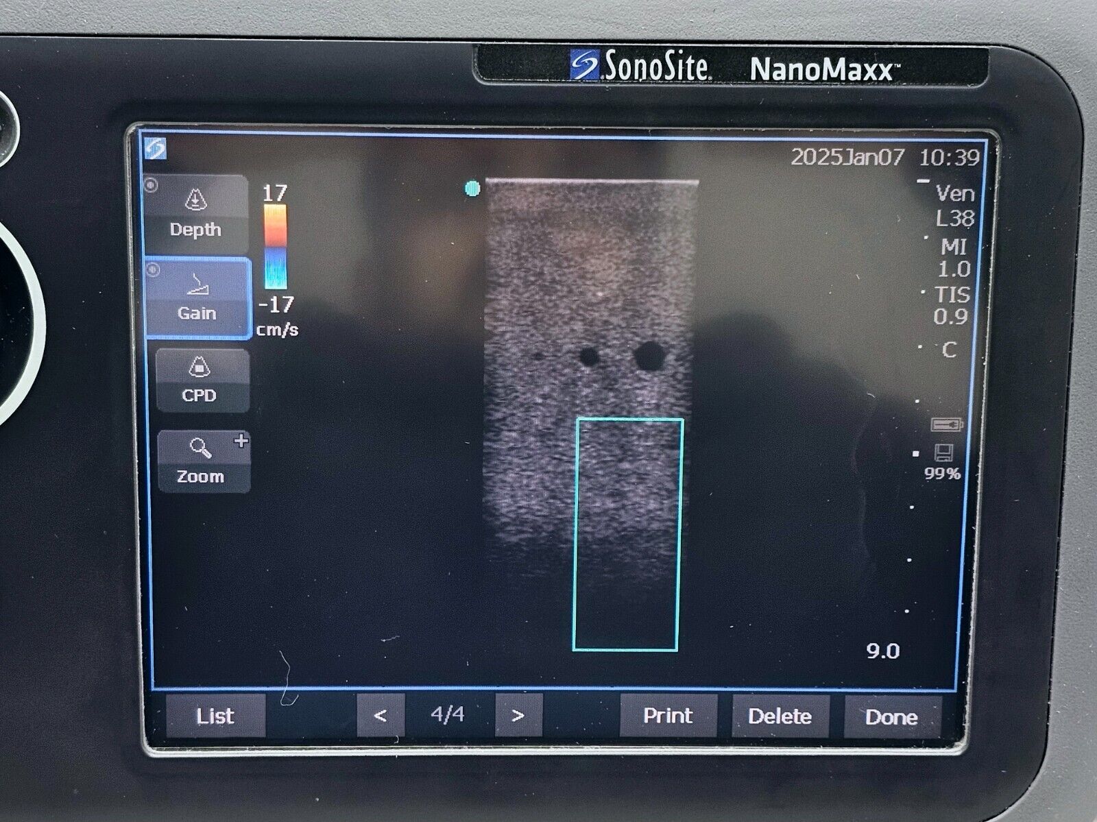 SonoSite NanoMaxx Ultrasound System P11111-37 w/ L38n-10-5 MHz Transducer