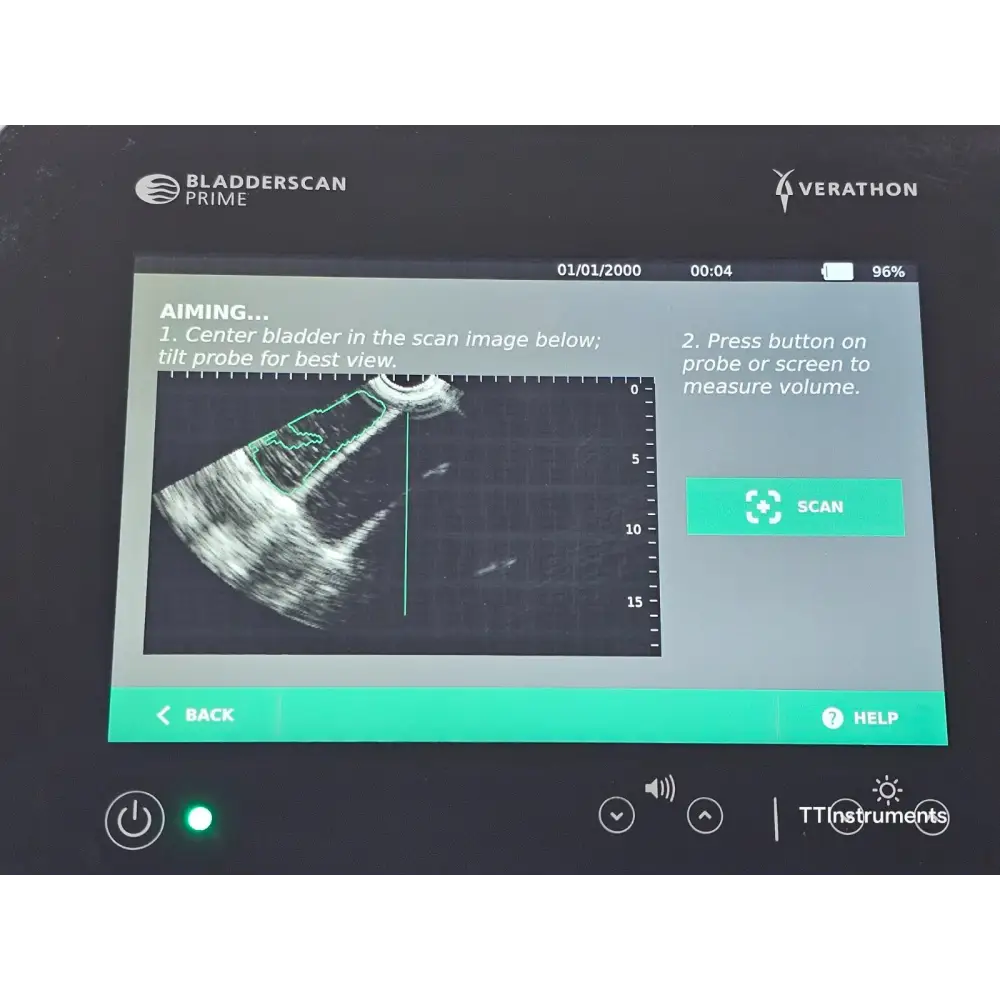 Verathon BladderScan PRIME probe tip and ultrasound transducer close-up