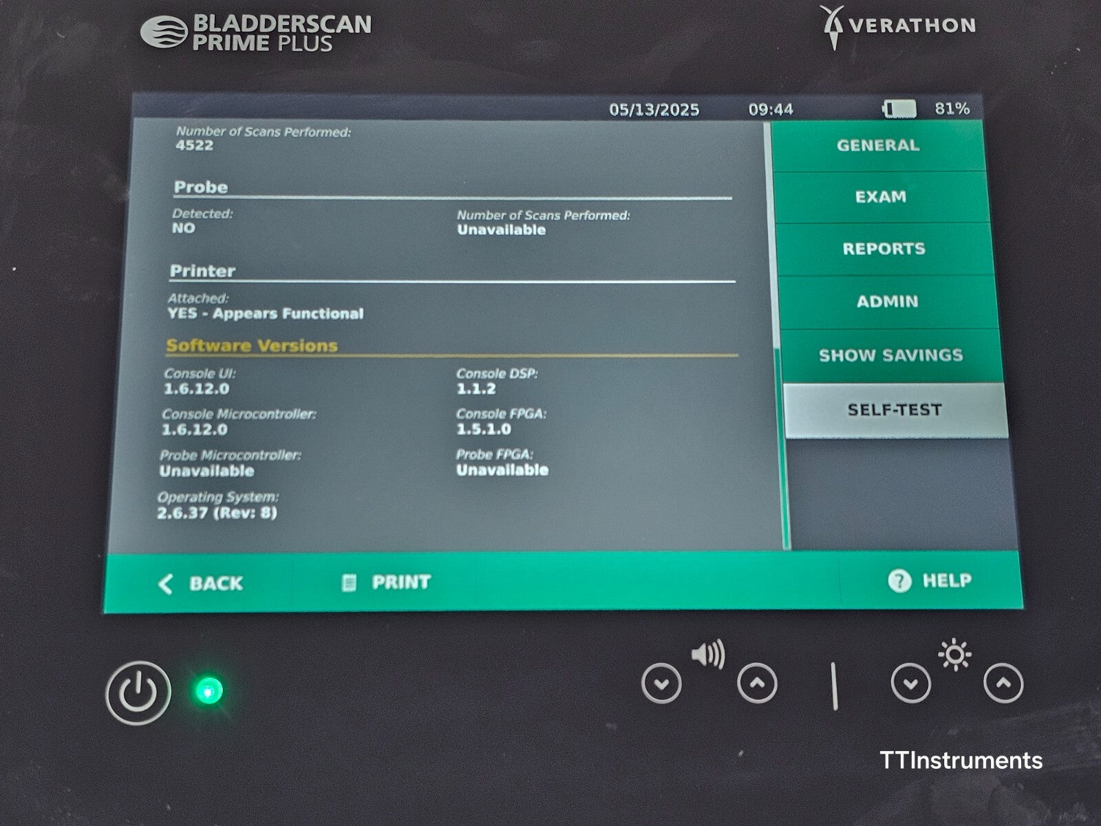 Verathon 0570-0394 BladderScan Prime Plus with Battery