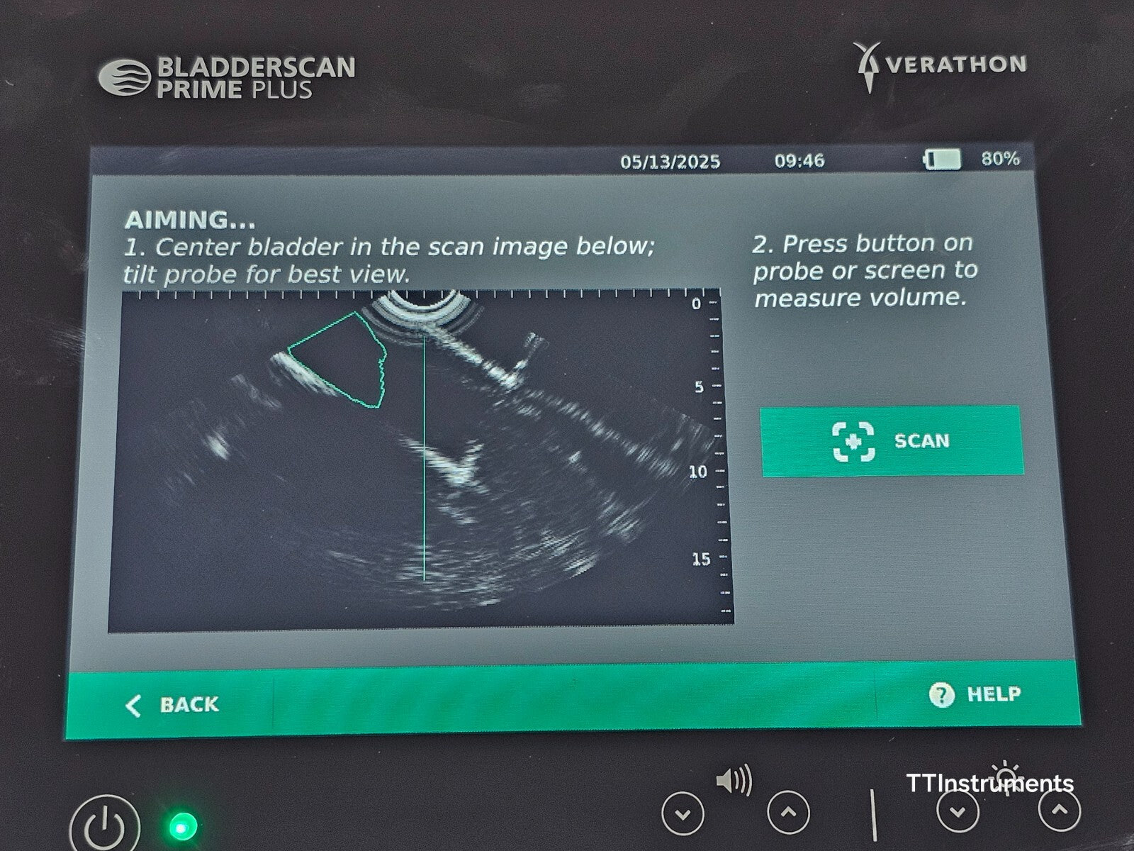 Verathon 0570-0394 BladderScan Prime Plus with Battery