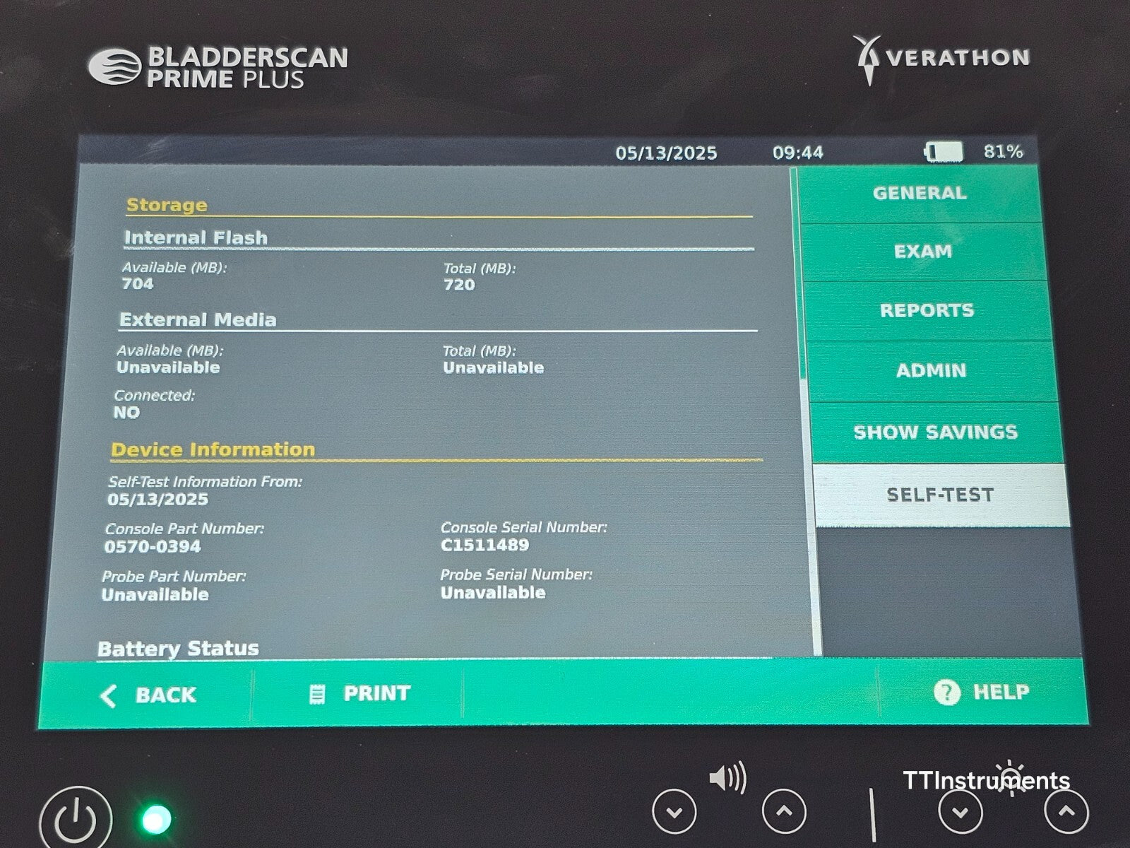 Verathon 0570-0394 BladderScan Prime Plus with Battery