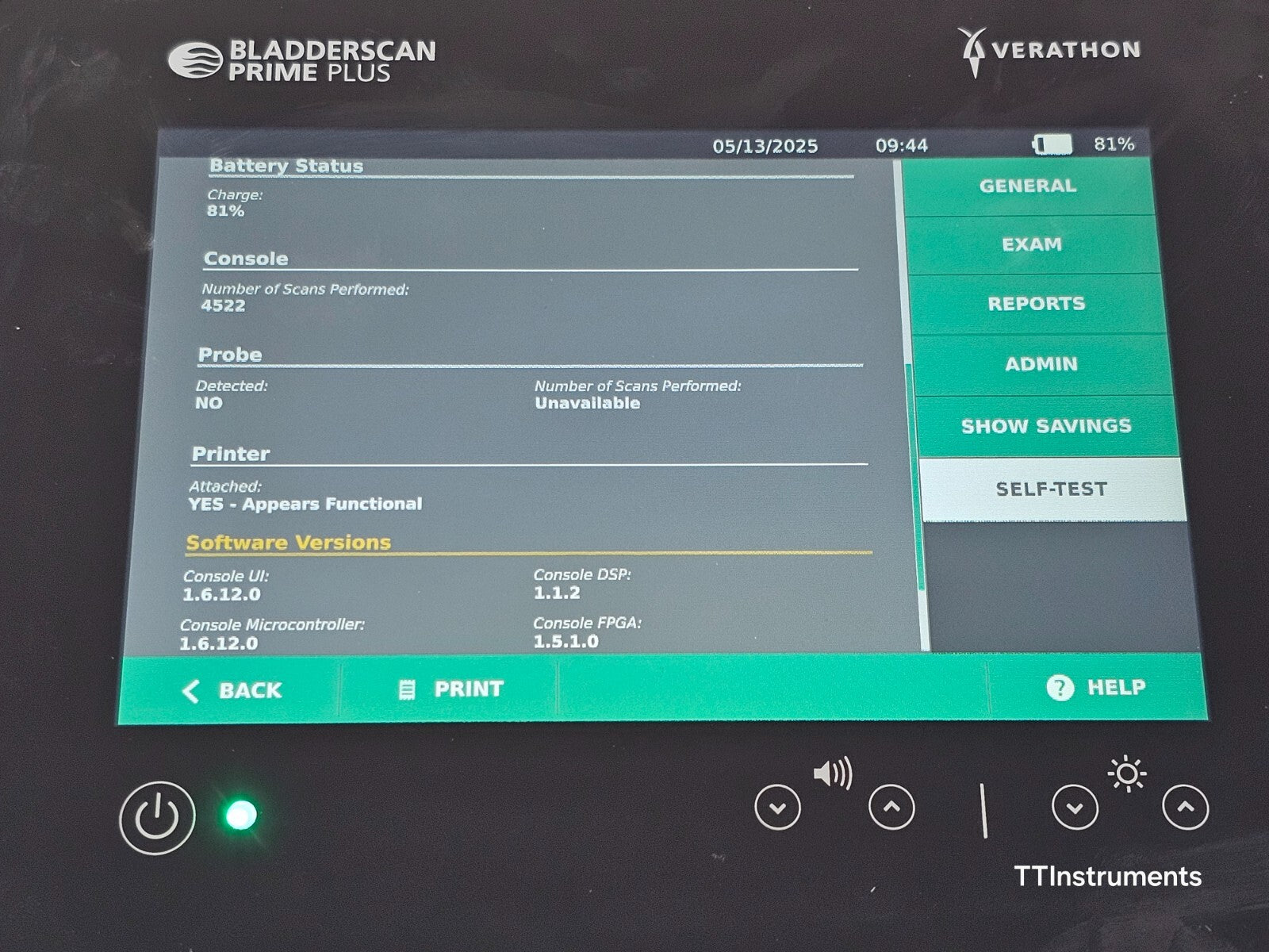 Verathon 0570-0394 BladderScan Prime Plus with Battery