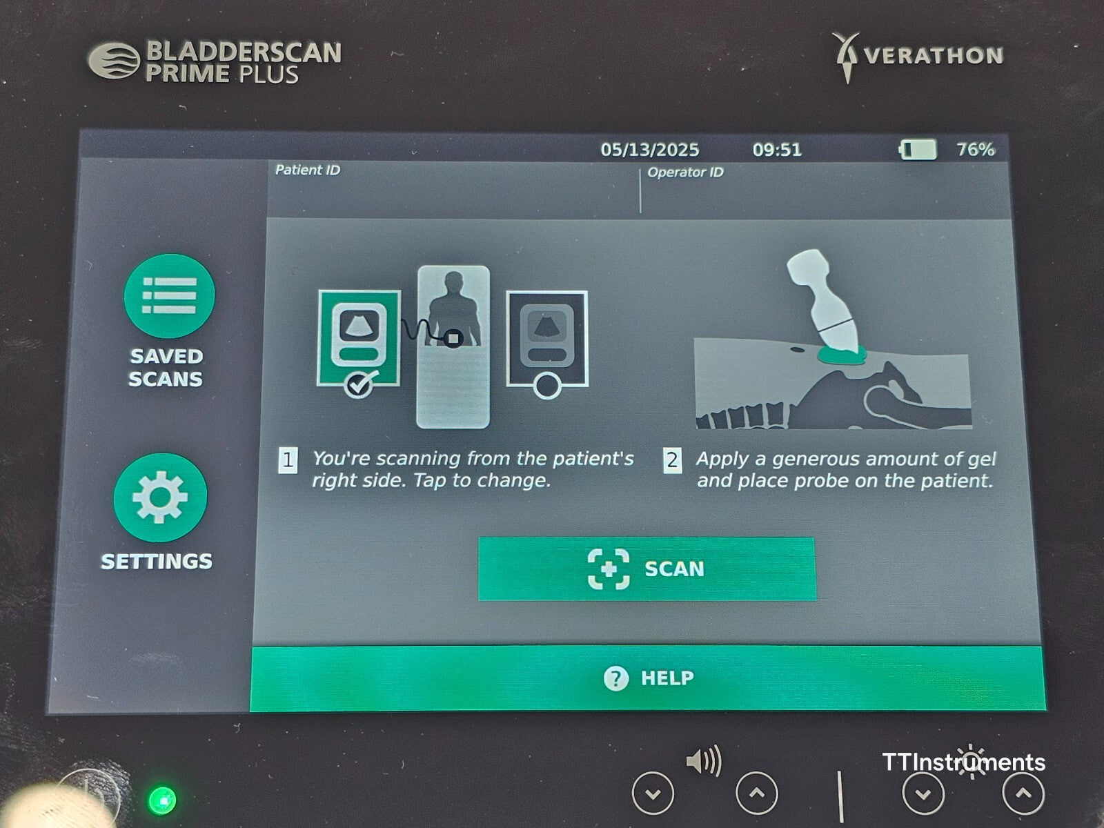 Verathon 0570-0394 BladderScan Prime Plus with Probe and Battery + Charger