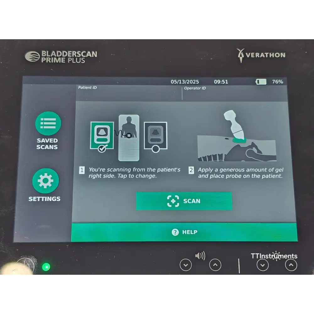Verathon BladderScan Prime Plus with probe connected to console