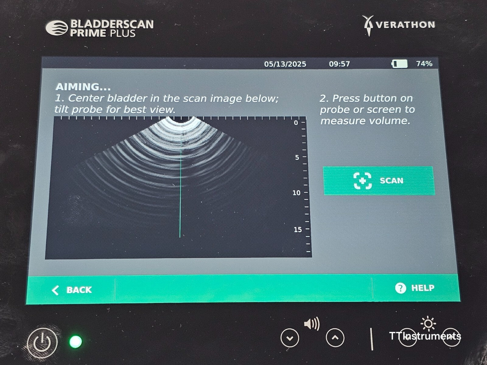 Verathon 0570-0394 BladderScan Prime Plus with Probe and Battery + Charger