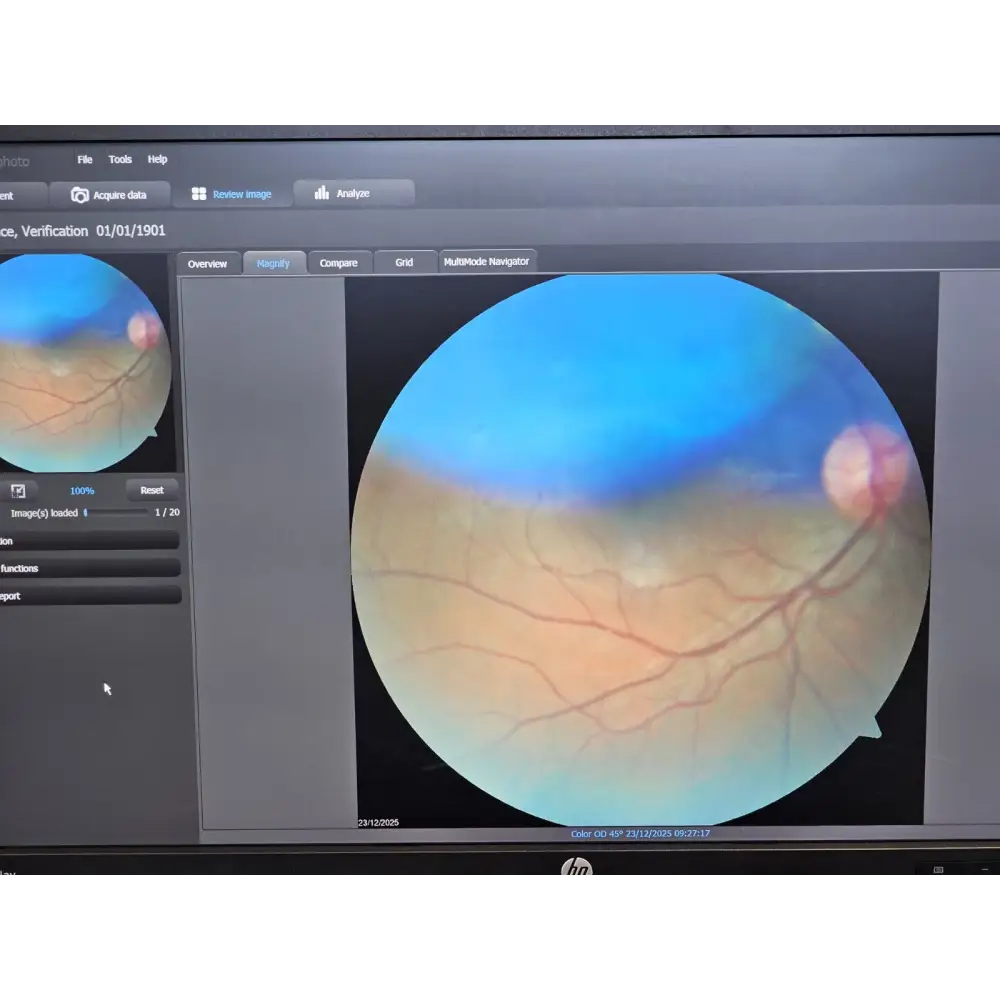 Zeiss Cirrus Photo 600 OCT Fundus Camera + OCT Engine + PC + Software
