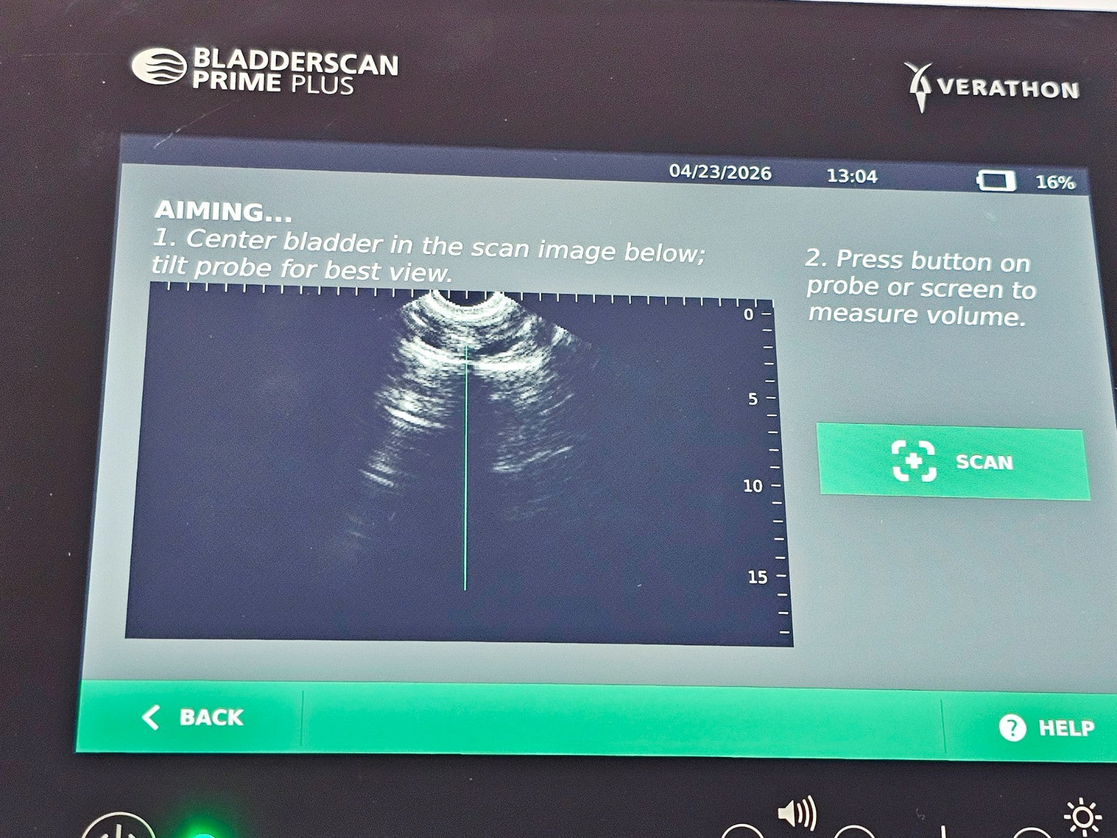 Verathon BladderScan complete set ready for clinical use