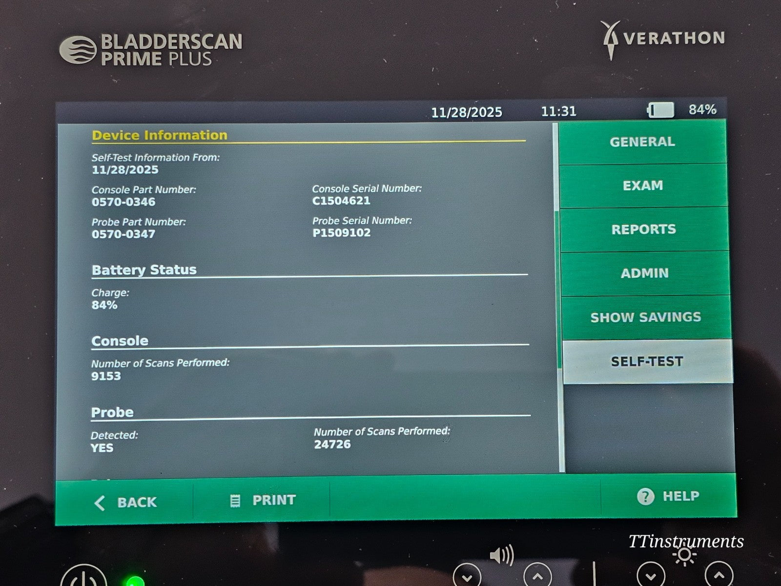 Verathon BladderScan Prime Plus console angled three-quarter view