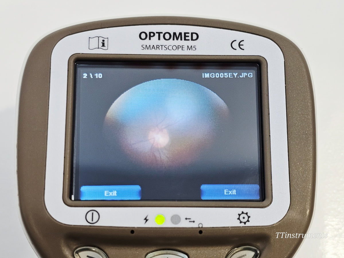 Optomed SmartScope M5 Handheld Fundus Camera with Accessories11