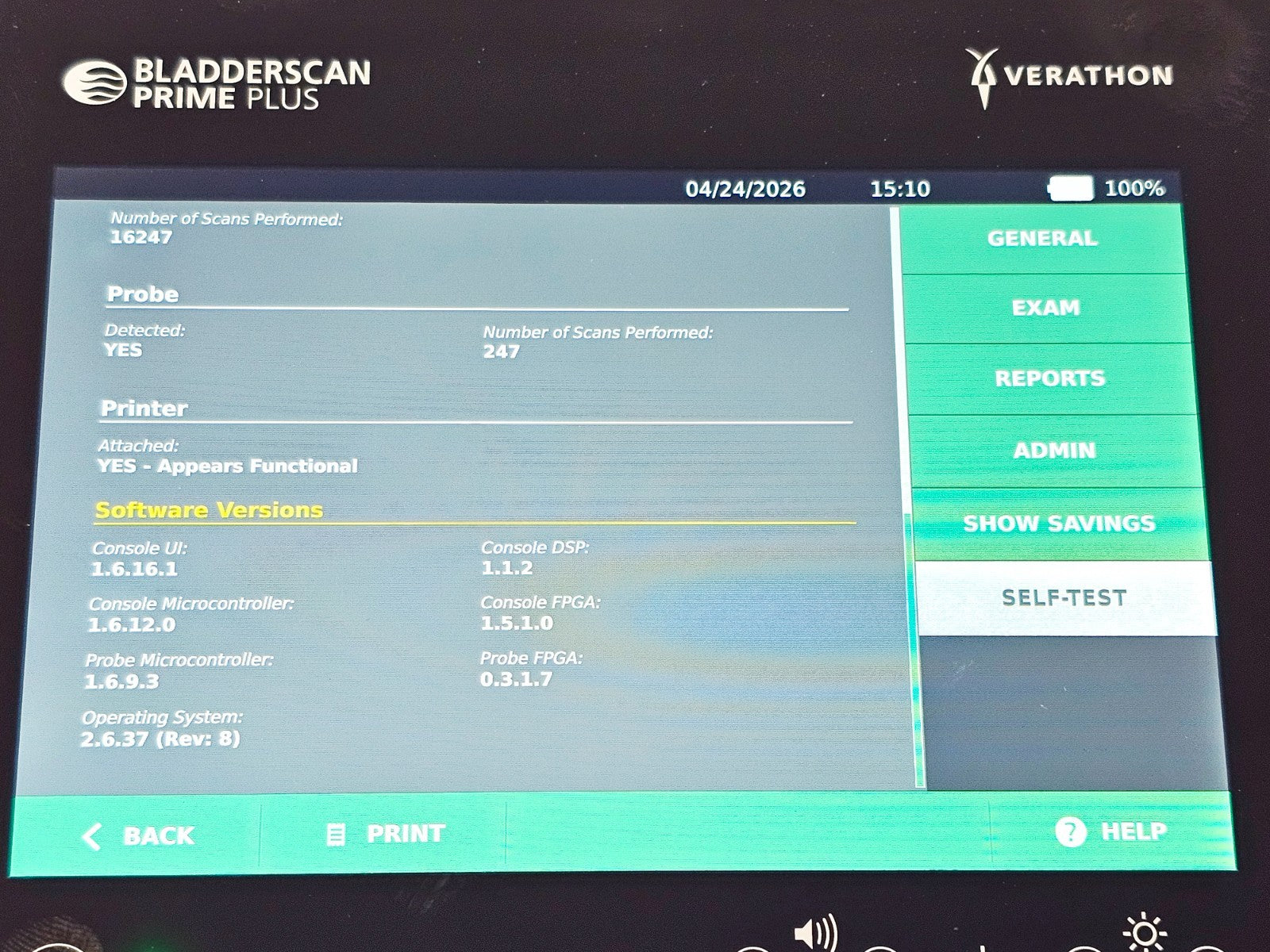 Verathon BladderScan portable ultrasound housing wear detail