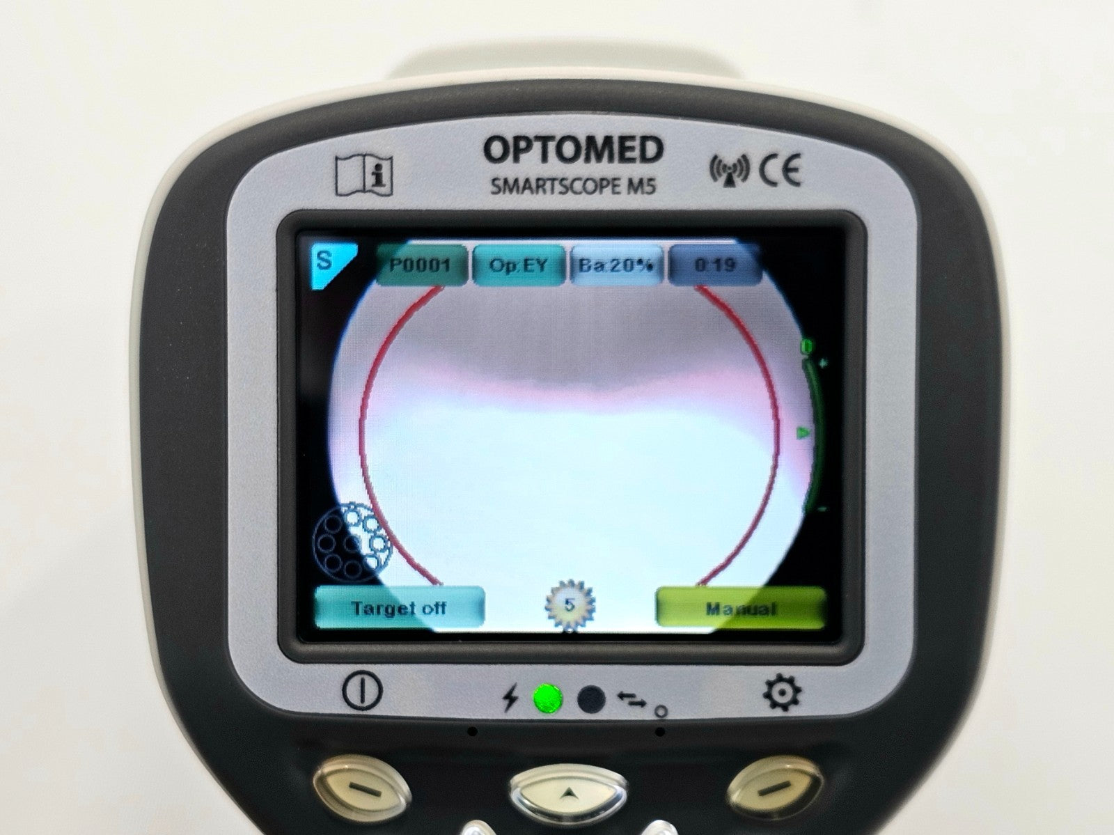 Optomed SmartScope M5 Handheld Fundus Camera + EY4 ES2 Cradle Slit Lamp Adapter