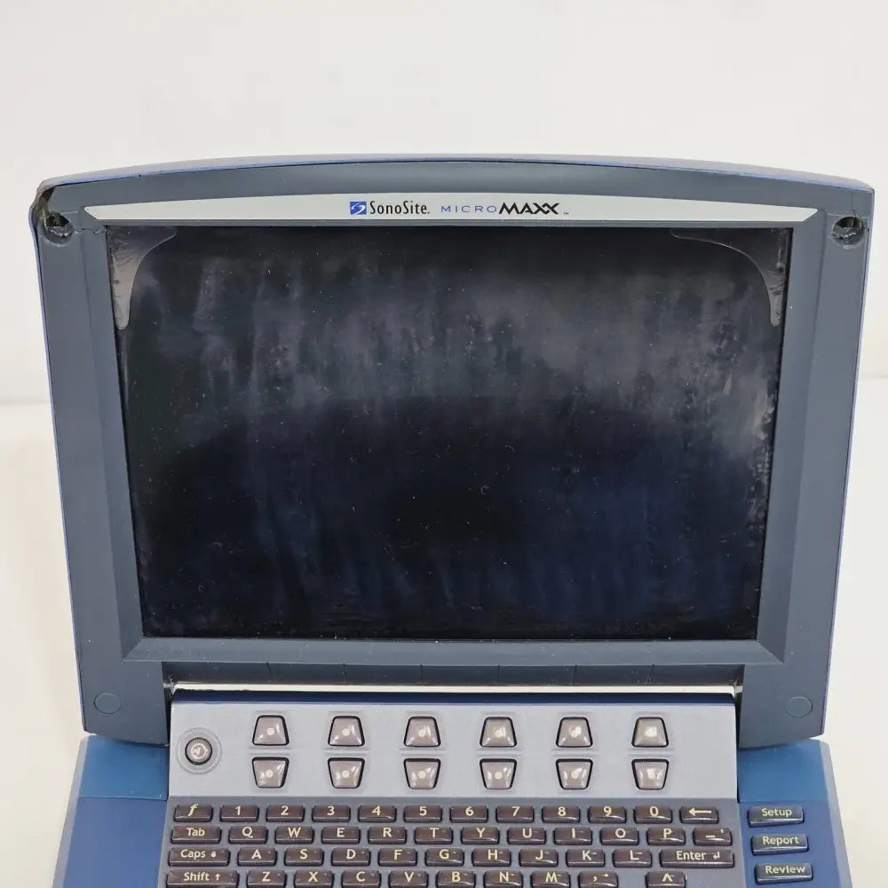 SonoSite MicroMaxx P08840-03 portable ultrasound system front view