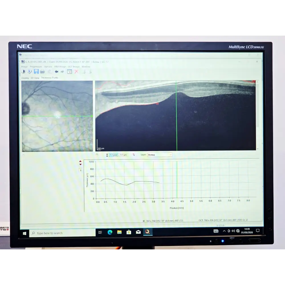 Heidelberg Engineering HRA + OCT Spectralis Imaging System MFD 2012