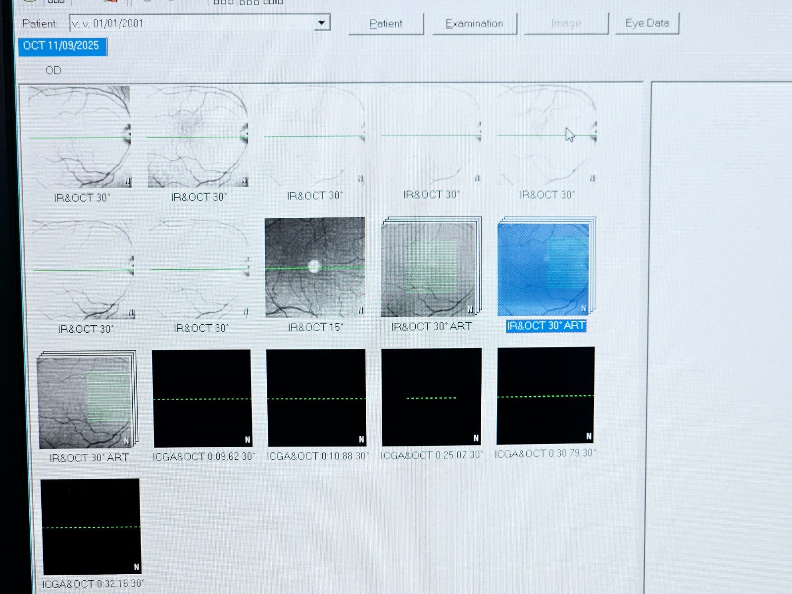 Heidelberg Engineering HRA + OCT Spectralis Optometry Imaging System w/ Software