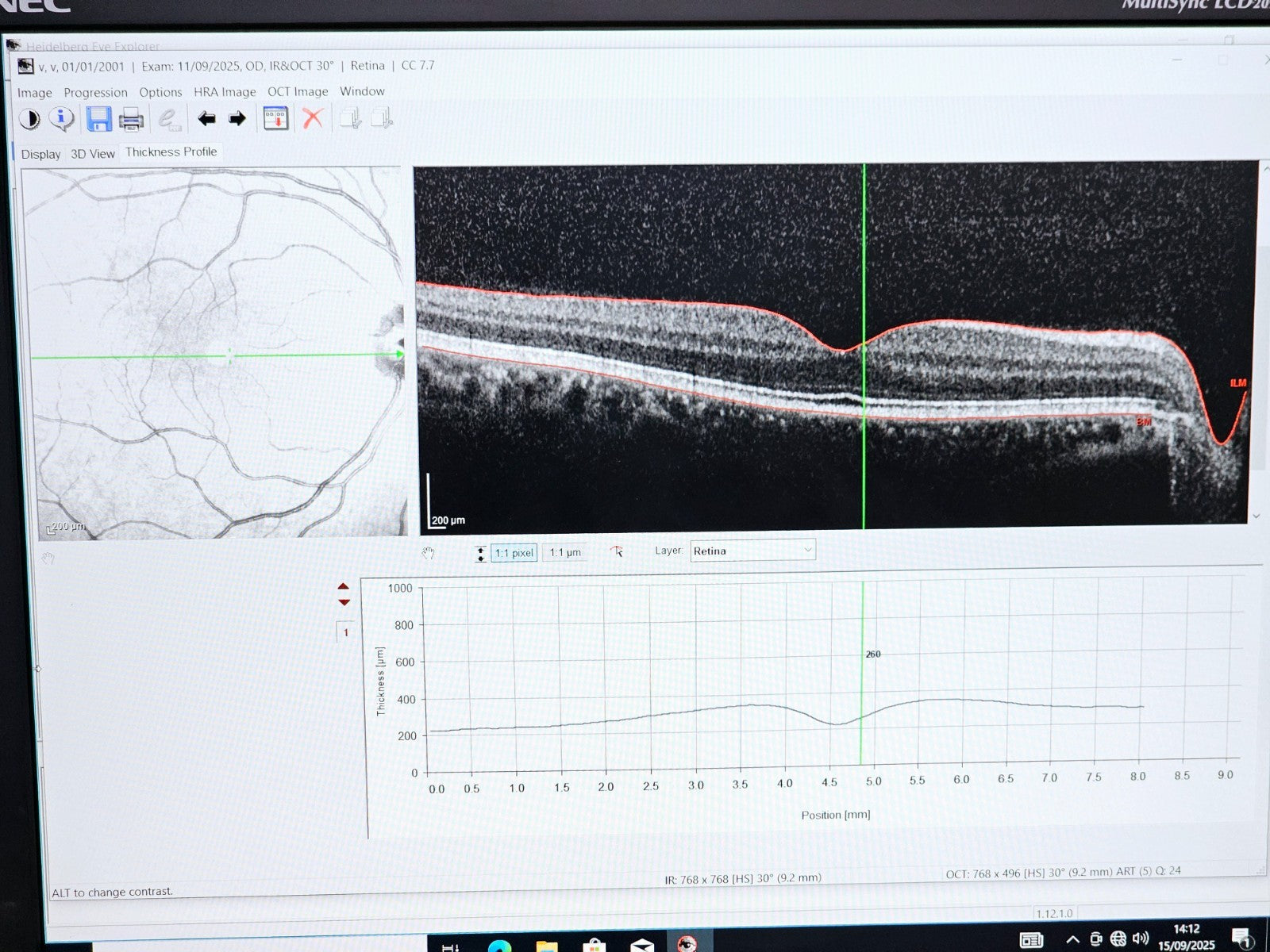 Heidelberg Engineering HRA + OCT Spectralis Optometry Imaging System w/ Software