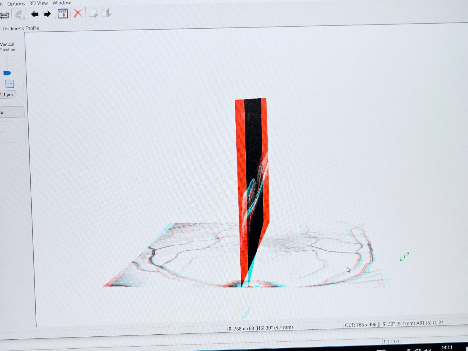 Heidelberg Engineering HRA + OCT Spectralis Optometry Imaging System w/ Software