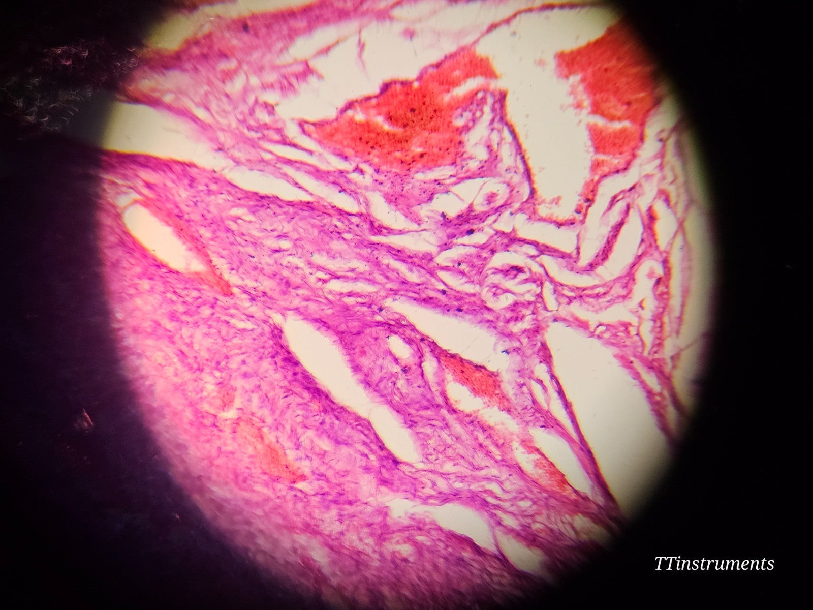 Olympus BX51TF Upright Fluorescence Microscope w/ Light Source + Objectives