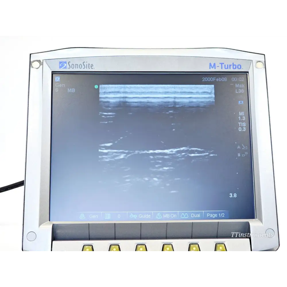 SonoSite M-Turbo ultrasound system right side profile view