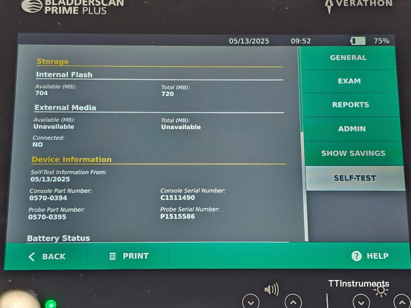 Verathon 0570-0394 BladderScan Prime Plus with Probe and Battery + Charger